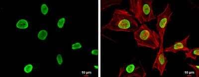 Immunocytochemistry/ Immunofluorescence: Histone H4 [ac Lys12, ac Lys16, ac Lys8, ac Lys5] Antibody [NBP2-16848]
