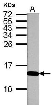 Western Blot: Histone H4 [ac Lys12, ac Lys16, ac Lys8, ac Lys5] Antibody [NBP2-16848]
