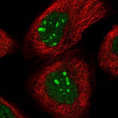 Immunocytochemistry/ Immunofluorescence: Homez Antibody [NBP2-32661]