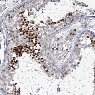 Immunohistochemistry: Homez Antibody [NBP2-32661]