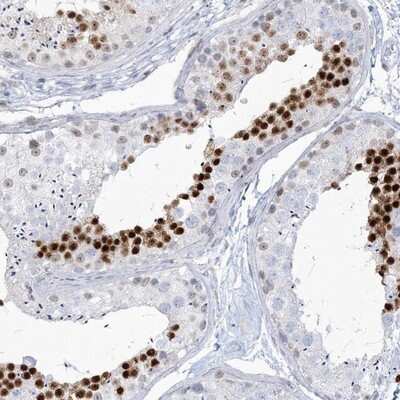 Immunohistochemistry-Paraffin: Homez Antibody [NBP1-81405]