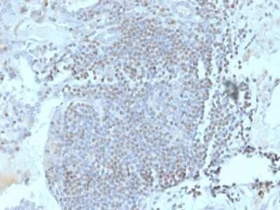 Immunohistochemistry-Paraffin: Homez Antibody (PCRP-HOMEZ-1A5) [NBP3-07257]