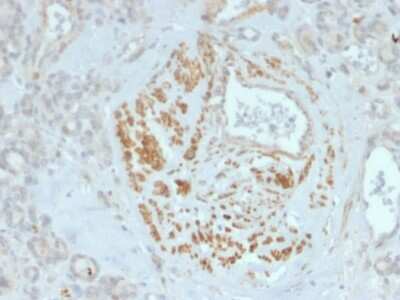 Immunohistochemistry-Paraffin: Homez Antibody (PCRP-HOMEZ-1B5) [NBP3-07258]