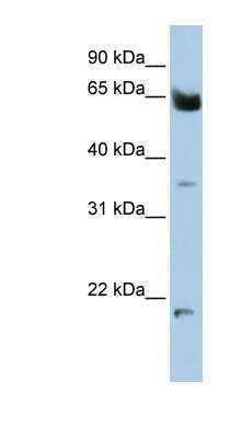 Western Blot: Homez Antibody [NBP1-79253]