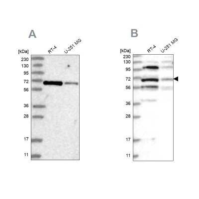 Western Blot: Homez Antibody [NBP1-81405]