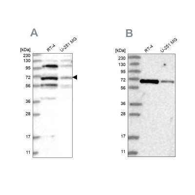 Western Blot: Homez Antibody [NBP2-32661]