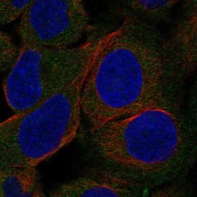 Immunocytochemistry/ Immunofluorescence: Hormone-sensitive Lipase/HSL Antibody [NBP2-58889]