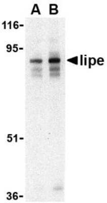 Western Blot: Hormone-sensitive Lipase/HSL AntibodyBSA Free [NBP1-76735]