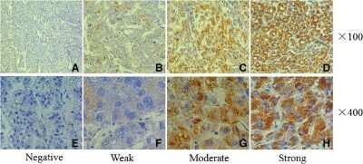Immunohistochemistry: Hornerin Antibody [NBP1-80807]