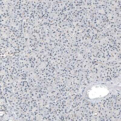 Immunohistochemistry-Paraffin: Hornerin Antibody [NBP1-80807]