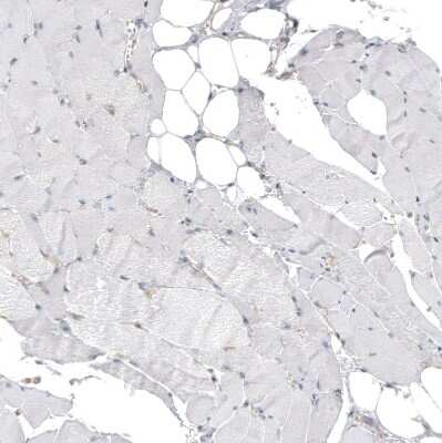 Immunohistochemistry-Paraffin: Hornerin Antibody [NBP1-80807]