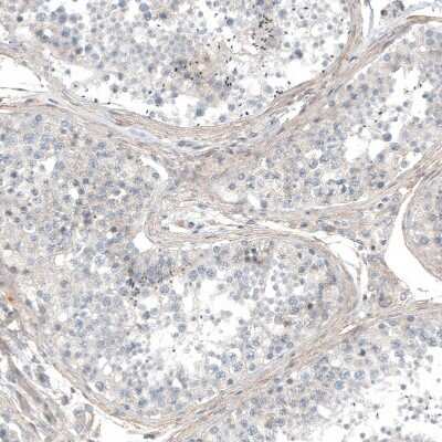 Immunohistochemistry-Paraffin: Hornerin Antibody [NBP1-80807]
