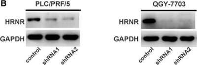 Knockdown Validated: Hornerin Antibody [NBP1-80807]