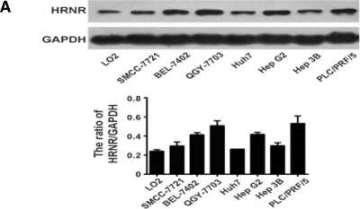 Western Blot: Hornerin Antibody [NBP1-80807]