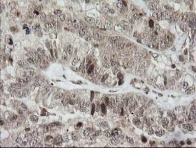 Immunohistochemistry: Host cell factor C2 Antibody (OTI5H9) - Azide and BSA Free [NBP2-71862]