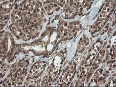 Immunohistochemistry: Host cell factor C2 Antibody (OTI5H9) - Azide and BSA Free [NBP2-71862]