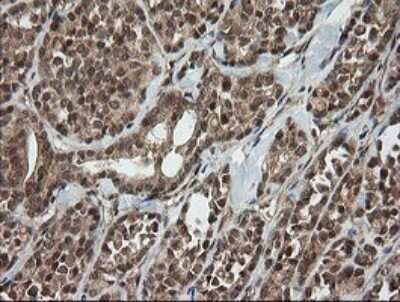 Immunohistochemistry: Host cell factor C2 Antibody (OTI5H9) [NBP2-45733]