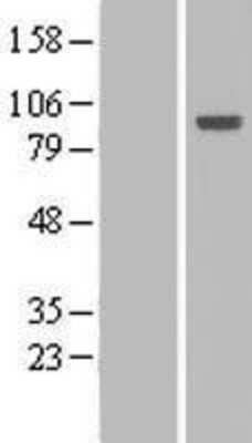 Western Blot: Host cell factor C2 Overexpression Lysate [NBL1-11469]