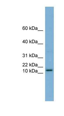 Western Blot: Hrk Antibody [NBP1-59447]