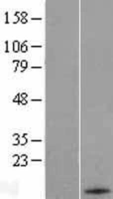 Western Blot: Hrk Overexpression Lysate [NBL1-11709]