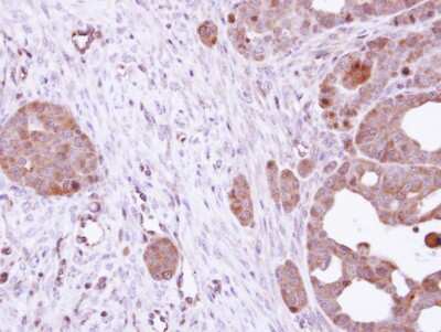 Immunohistochemistry-Paraffin: HSPA8/HSC71/Hsc70 Antibody [NBP2-16881]