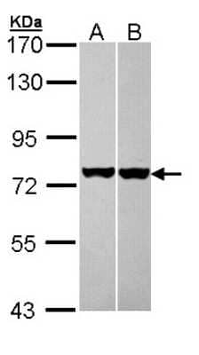Western Blot: HSPA8/HSC71/Hsc70 Antibody [NBP2-16882]