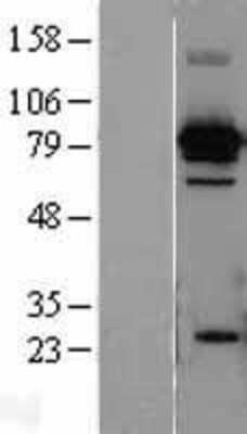 Western Blot: HSPA8/HSC71/Hsc70 Overexpression Lysate [NBL1-11755]