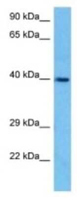 Western Blot: Hsd3b5 Antibody [NBP3-10145]