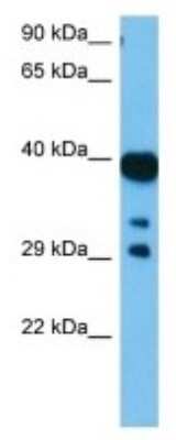 Western Blot: Hsd3b6 Antibody [NBP3-10130]