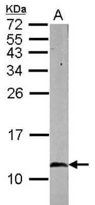 Western Blot: HSP10/EPF Antibody [NBP2-16890]