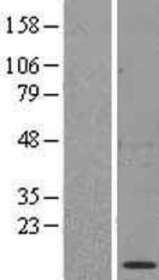 Western Blot: HSP10/EPF Overexpression Lysate [NBL1-11768]