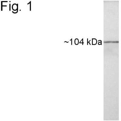 Western Blot: Hsp104 Antibody [NB100-74442]