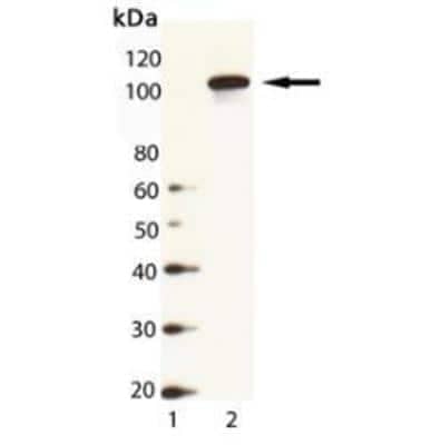 Western Blot: Hsp104 Antibody [NBP1-97473]