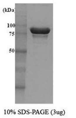 SDS-PAGE: Recombinant Yeast Hsp104 Protein [NBC1-18363]