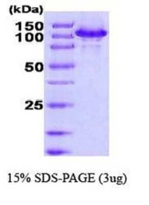 SDS-PAGE: Recombinant Human HSPH1/HSP105 His Protein [NBC1-18374]