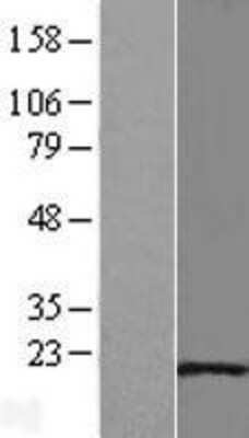 Western Blot: HSP20/HSPB6 Overexpression Lysate [NBL1-11759]