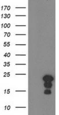 Western Blot: HSPB8/HSP22 Antibody (OTI1E3) [NBP2-02576]