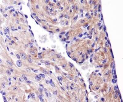 Immunohistochemistry: HSP27 Antibody - BSA Free [NBP1-75477]