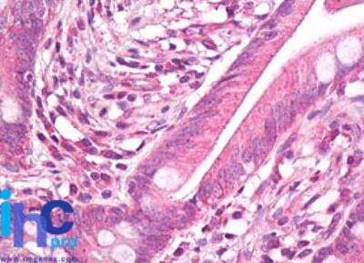 Immunohistochemistry-Paraffin: HSP27 Antibody [NBP2-24533]