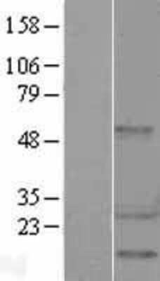 Western Blot: HSP27 Overexpression Lysate [NBL1-11757]