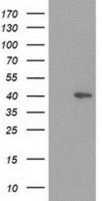 Western Blot: HSP40/DNAJB1 Antibody (OTI1F9) [NBP2-03433]