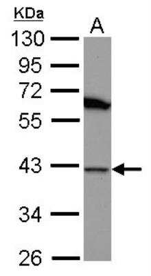 Western Blot: HSP40/DNAJB1 Antibody [NBP2-16892]