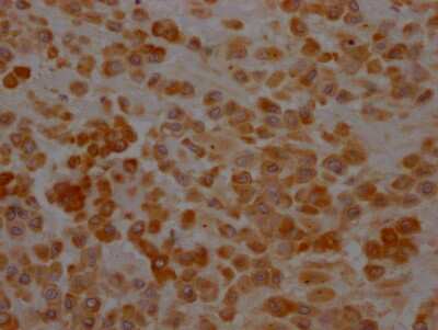 Immunohistochemistry: Hsp47 Antibody (10B2) [NBP3-15163]