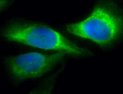 Immunocytochemistry/ Immunofluorescence: Hsp47 Antibody (1C4-1A6) [NBP2-22400]