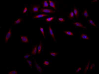 Immunocytochemistry/ Immunofluorescence: Hsp47 Antibody (1C4-1A6) [NBP2-22400]
