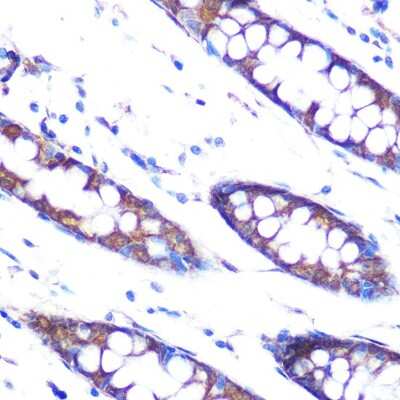 Immunohistochemistry-Paraffin: Hsp47 Antibody (3K3H1) [NBP3-15430]