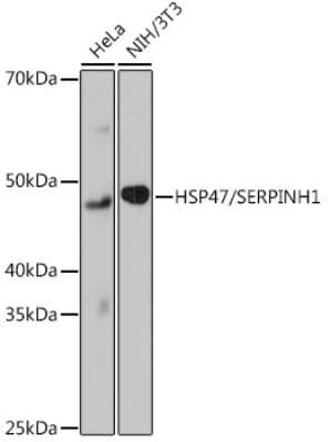 Western Blot: Hsp47 Antibody (3K3H1) [NBP3-15430]