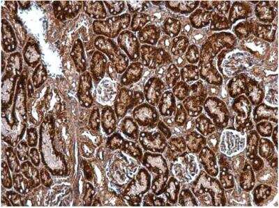Immunohistochemistry-Paraffin: Hsp47 Antibody [NBP2-16893]