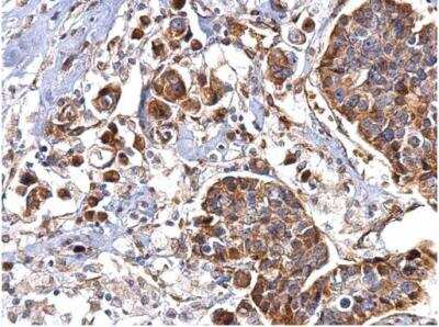 Immunohistochemistry-Paraffin: Hsp47 Antibody [NBP2-16893]