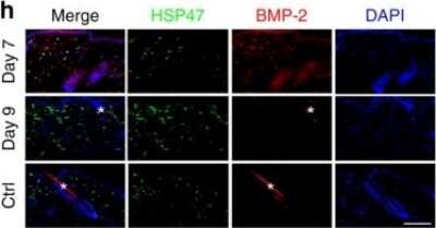 Immunocytochemistry/ Immunofluorescence: Hsp47 Antibody (M16.10A1) [NBP1-97491]